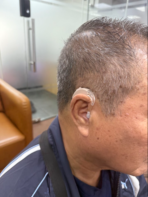 Máy trợ thính Acosound L4-BTE-P - Ảnh 2