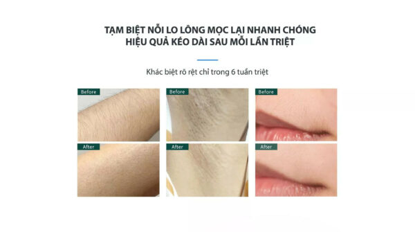 hang-tot-nhap-khau-may-triet-long-mini-sapphire-b65-pro-031122-8